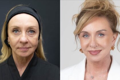 “Bem-vindos ao luxo”: facelift reforça imagem de corretora de alto padrão